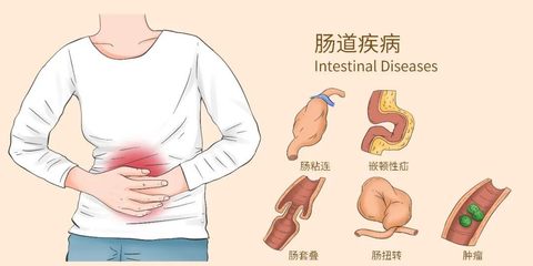 胃粘连怎么治疗方法