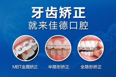 矫正牙齿隐形牙套价位
