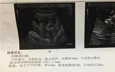 怀孕24周肚子疼是怎么回事