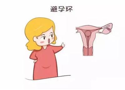 取环后是不是很难怀孕