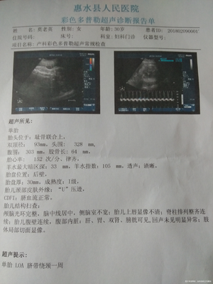 35周胎儿图片
