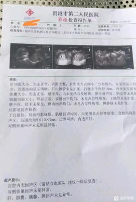 两个月堕胎