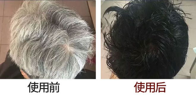 不伤头皮的染发剂