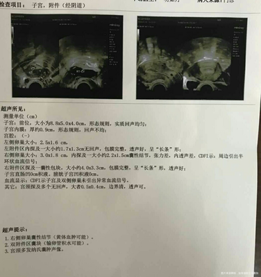 卵泡一个月有几个