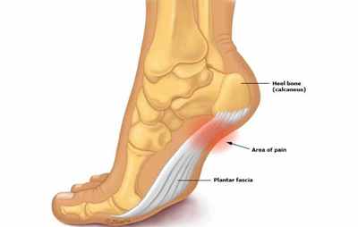后脚跟痛是怎么回事
