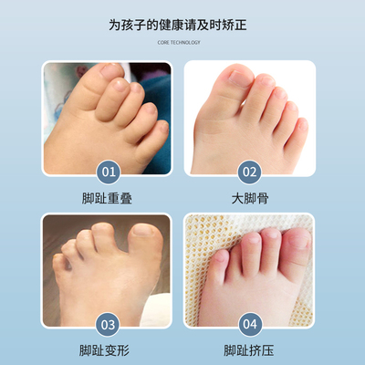 宝宝脚趾重叠图片