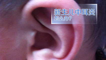 中耳炎症状怎么治疗