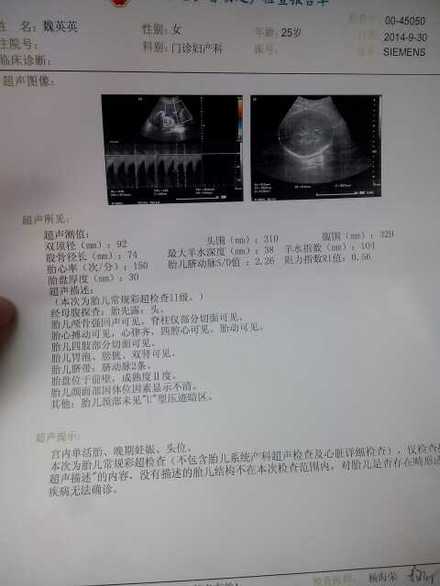 胎儿标准对照表