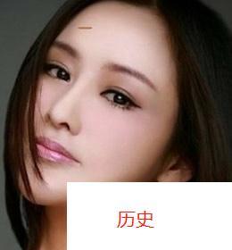 额头有疤痕的女孩命运