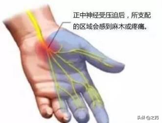 手指头麻木怎么治疗