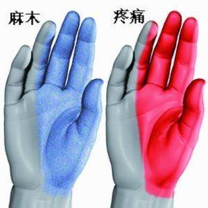 右手无名指麻木是怎么回事