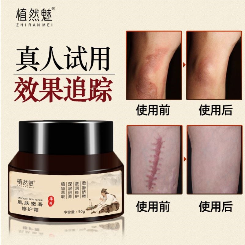 什么去痘印最有效品牌