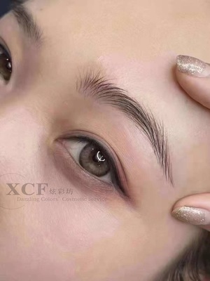 眉毛中间出痘痘能挤吗