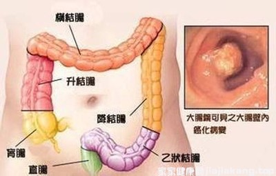 直肠疼痛是怎么回事