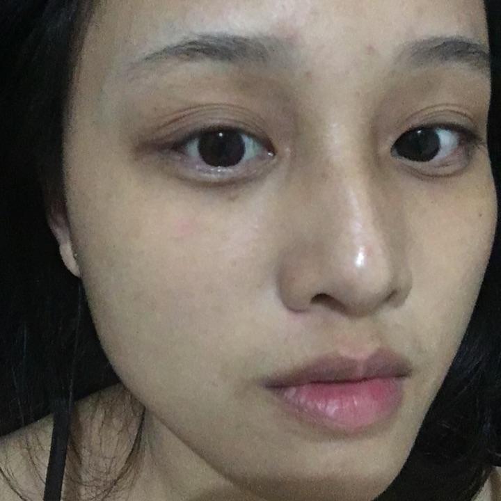 右脸颊为什么会长痘痘