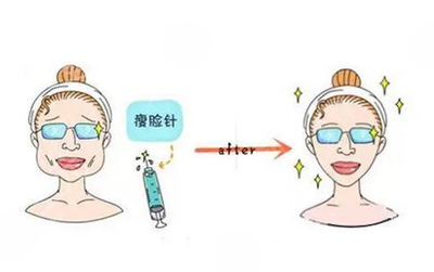 瘦脸针多久稳定